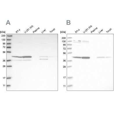 Western Blot: CNPase Antibody [NBP1-85998]