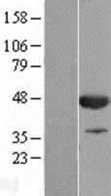 Western Blot: CNPase Overexpression Lysate [NBL1-09322]