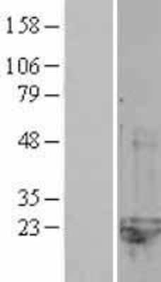 Western Blot: CNRIP1 Overexpression Lysate [NBL1-09329]