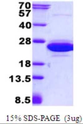 SDS-PAGE: Recombinant Human CNRIP1 His Protein [NBP2-22728]