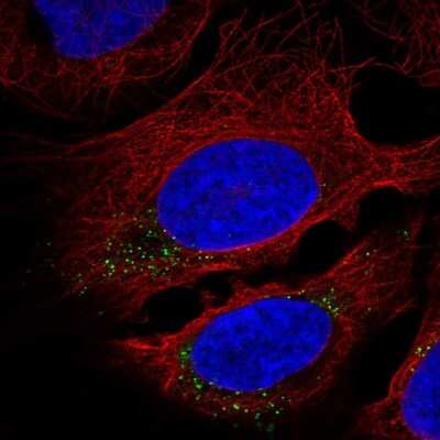 Immunocytochemistry/ Immunofluorescence: CNST Antibody [NBP2-58901]