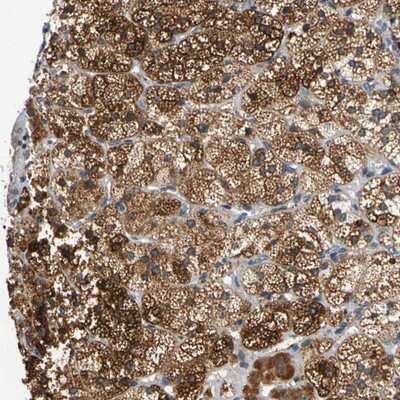 Immunohistochemistry-Paraffin: CNST Antibody [NBP1-90702]