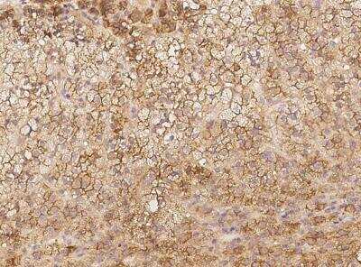 Immunohistochemistry-Paraffin: CNST Antibody [NBP3-06530]