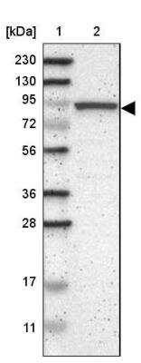 Western Blot: CNST Antibody [NBP1-90702]