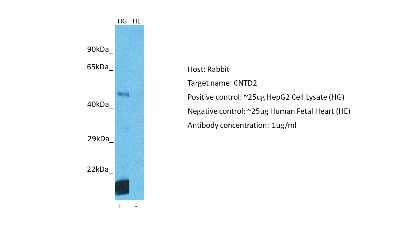 Western Blot: CNTD2 Antibody [NBP2-82721]