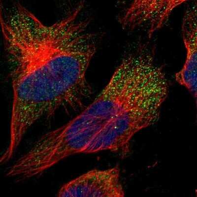 Immunocytochemistry/ Immunofluorescence: CNTF Antibody [NBP1-83277]