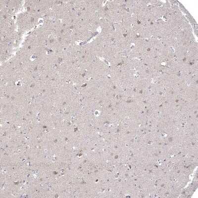 Immunohistochemistry-Paraffin: CNTF Antibody [NBP1-83277]