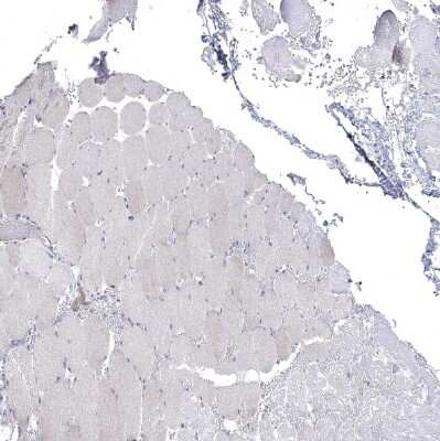 Immunohistochemistry-Paraffin: CNTF Antibody [NBP1-83277]