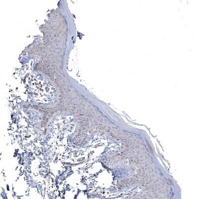 Immunohistochemistry-Paraffin: CNTF Antibody [NBP1-83277]