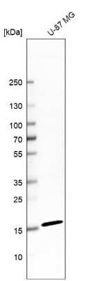 Western Blot: CNTF Antibody [NBP1-83277]