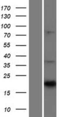 Western Blot: CNTF Overexpression Lysate [NBP2-09006]