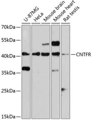 Western Blot: CNTFR AntibodyBSA Free [NBP2-92414]