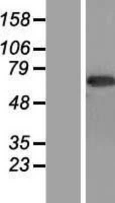 Western Blot: CNTFR Overexpression Lysate [NBP2-08172]