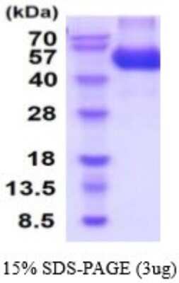 SDS-PAGE: Recombinant Rat CNTFR His Protein [NBP2-53071]