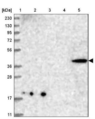 Western Blot: CNTLN Antibody [NBP1-88795]