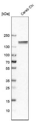 Western Blot: CNTNAP4 Antibody [NBP1-86619]