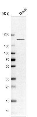 Western Blot: CNTNAP4 Antibody [NBP2-33829]