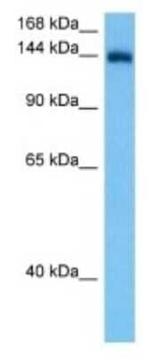 Western Blot: CNTNAP5B Antibody [NBP3-10241]