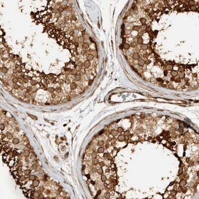 Immunohistochemistry-Paraffin: CNTROB Antibody [NBP1-82834]