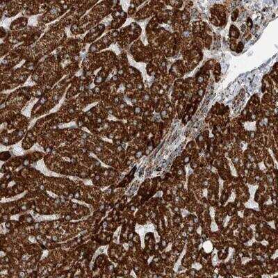 Immunohistochemistry-Paraffin: CNTROB Antibody [NBP1-82836]