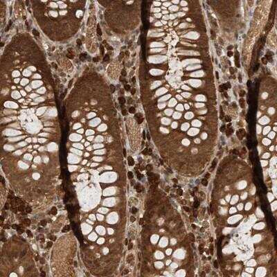 Immunohistochemistry-Paraffin: CNTROB Antibody [NBP1-82837]