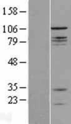 Western Blot: CNTROB Overexpression Lysate [NBL1-09339]