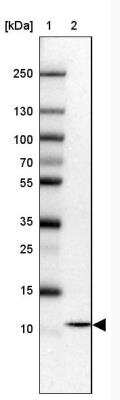 Western Blot: COA5 Antibody [NBP2-31690]