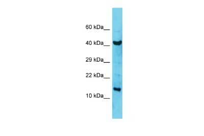 Western Blot: COA6 Antibody [NBP2-82729]