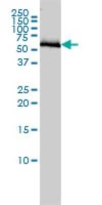 Western Blot: COASY Antibody (1H6) [H00080347-M01]