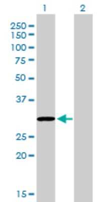 Western Blot: COASY Antibody (1H6) [H00080347-M01]