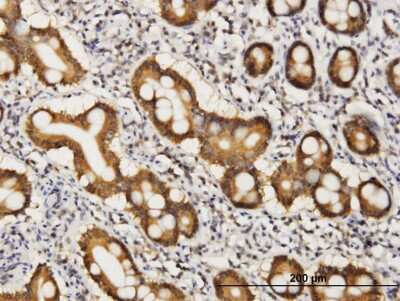 Immunohistochemistry-Paraffin: COASY Antibody (2A12) [H00080347-M05]