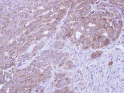 Immunohistochemistry-Paraffin: COASY Antibody [NBP1-32649]