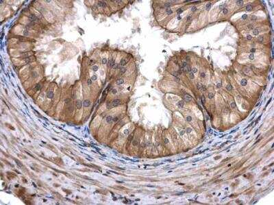Immunohistochemistry-Paraffin: COASY Antibody [NBP1-32649]
