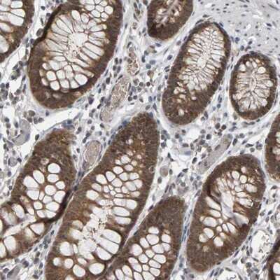 Immunohistochemistry-Paraffin: COASY Antibody [NBP1-84990]