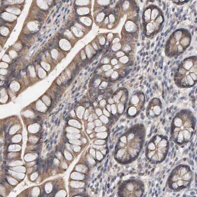 Immunohistochemistry-Paraffin: COASY Antibody [NBP1-84991]