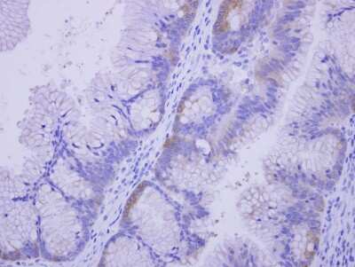 Immunohistochemistry-Paraffin: COASY Antibody [NBP2-15934]