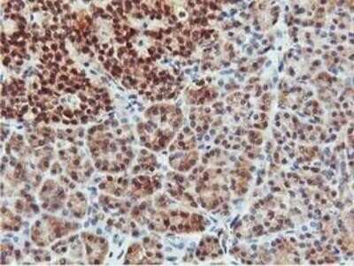 Immunohistochemistry: COASY Antibody (OTI3B3) - Azide and BSA Free [NBP2-72224]