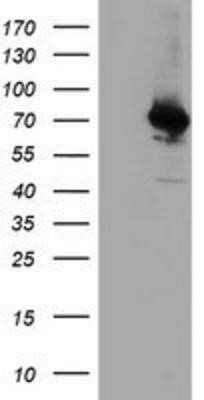 Western Blot: COASY Antibody (OTI3B3)Azide and BSA Free [NBP2-72224]