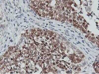 Immunohistochemistry-Paraffin: COASY Antibody (OTI3B3) [NBP2-01081]