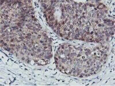 Immunohistochemistry-Paraffin: COASY Antibody (OTI3B3) [NBP2-01081]