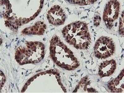 Immunohistochemistry-Paraffin: COASY Antibody (OTI3B3) [NBP2-01081]
