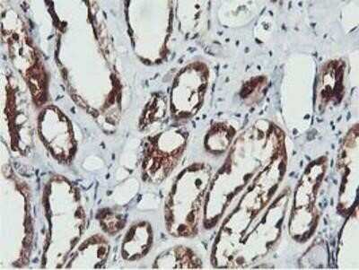 Immunohistochemistry-Paraffin: COASY Antibody (OTI3B3) [NBP2-01081]