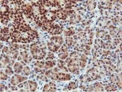 Immunohistochemistry-Paraffin: COASY Antibody (OTI3B3) [NBP2-01081]