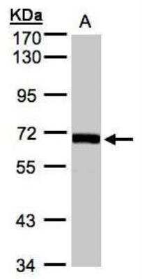 Western Blot: COASY Antibody [NBP1-32649]