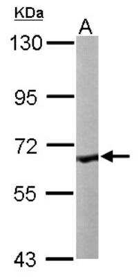 Western Blot: COASY Antibody [NBP1-32649]