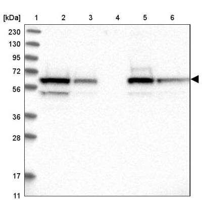 Western Blot: COASY Antibody [NBP1-84990]