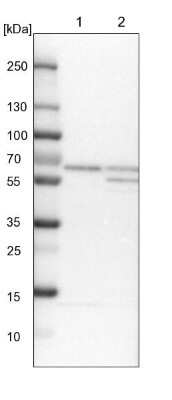 Western Blot: COASY Antibody [NBP1-84990]