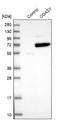 Western Blot: COASY Antibody [NBP1-84991]