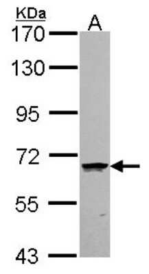 Western Blot: COASY Antibody [NBP2-15934]