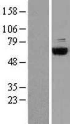 Western Blot: COASY Overexpression Lysate [NBP2-08384]